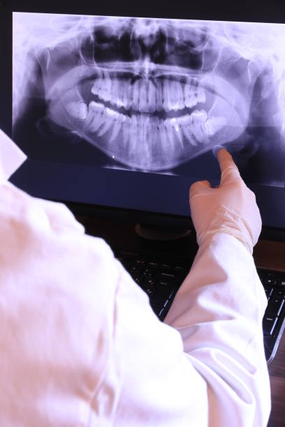 Best Broken or Cracked Tooth Emergency Dentist in USA